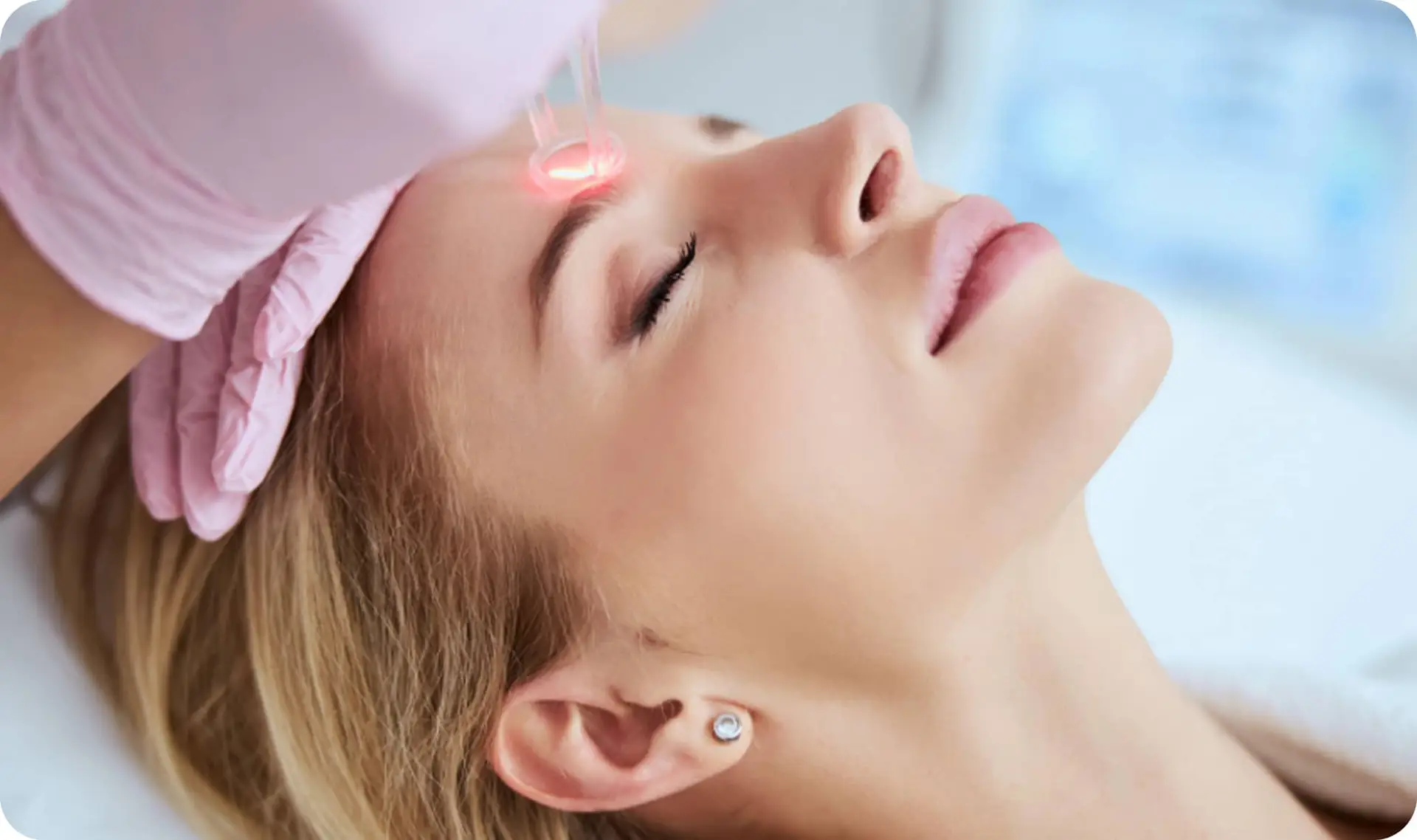 Restore smooth, radiant skin with advanced fractional laser resurfacing at Arielyn’s Skin & Beauty. This treatment targets fine lines, acne scars, uneven texture, and sun damage by stimulating collagen and promoting skin renewal. Safe, effective, and personalized, it delivers visible results with minimal downtime. Book your consultation in Bonnyville today!